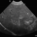 ecografía normal perro